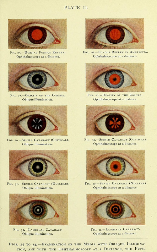 Manual of the Diseases of the Eye: For Students and General Practitioners