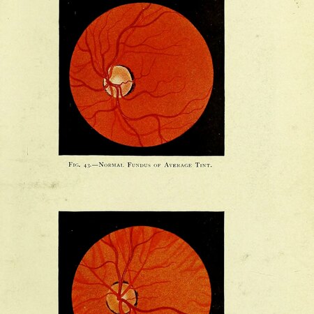 Manual of the Diseases of the Eye: For Students and General Practitioners