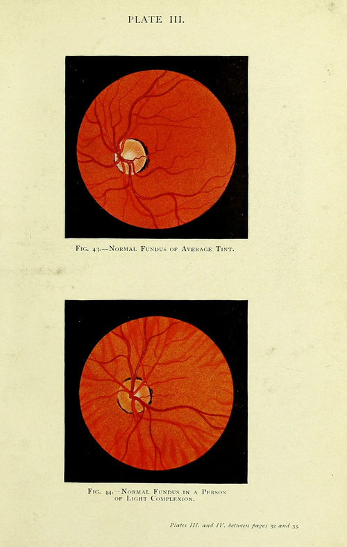 Manual of the Diseases of the Eye: For Students and General Practitioners