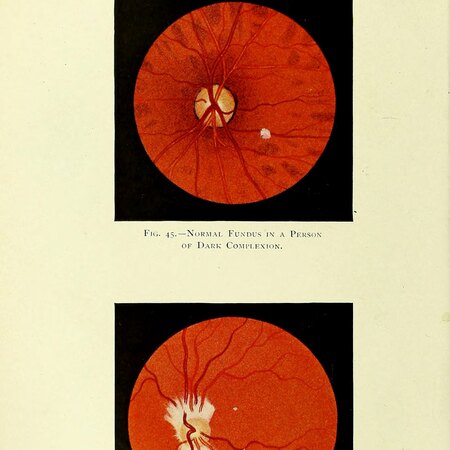 Manual of the Diseases of the Eye: For Students and General Practitioners