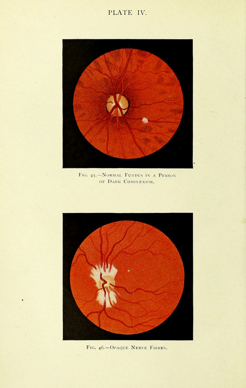 Manual of the Diseases of the Eye: For Students and General Practitioners