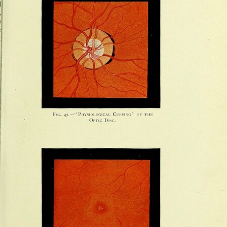 Manual of the Diseases of the Eye: For Students and General Practitioners