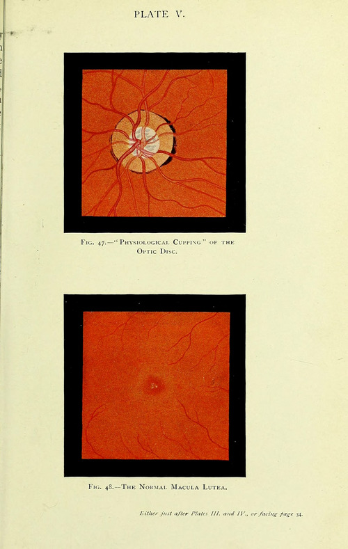 Manual of the Diseases of the Eye: For Students and General Practitioners