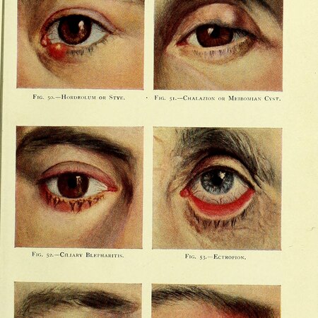 Manual of the Diseases of the Eye: For Students and General Practitioners