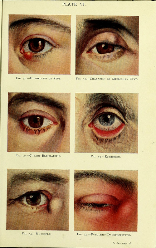 Manual of the Diseases of the Eye: For Students and General Practitioners