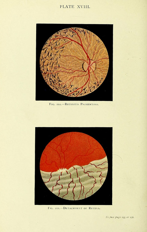 Manual of the Diseases of the Eye: For Students and General Practitioners