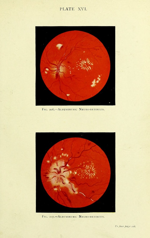 Manual of the Diseases of the Eye: For Students and General Practitioners